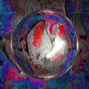 Uruly - Infarto do Miocárdio Catastrófico